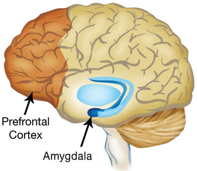 Hypnotherapy Vs Exposure Therapy Brain Chart